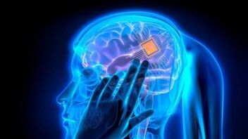 Implants cérébraux : la science accélère et le cerveau devient une nouvelle interface