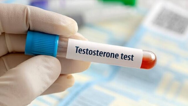 Royaume-Uni : des femmes ménopausées se font passer pour des hommes afin d’acheter de la testostérone Royaume-Uni : des femmes ménopausées se font passer pour des hommes afin d’acheter de la testostérone