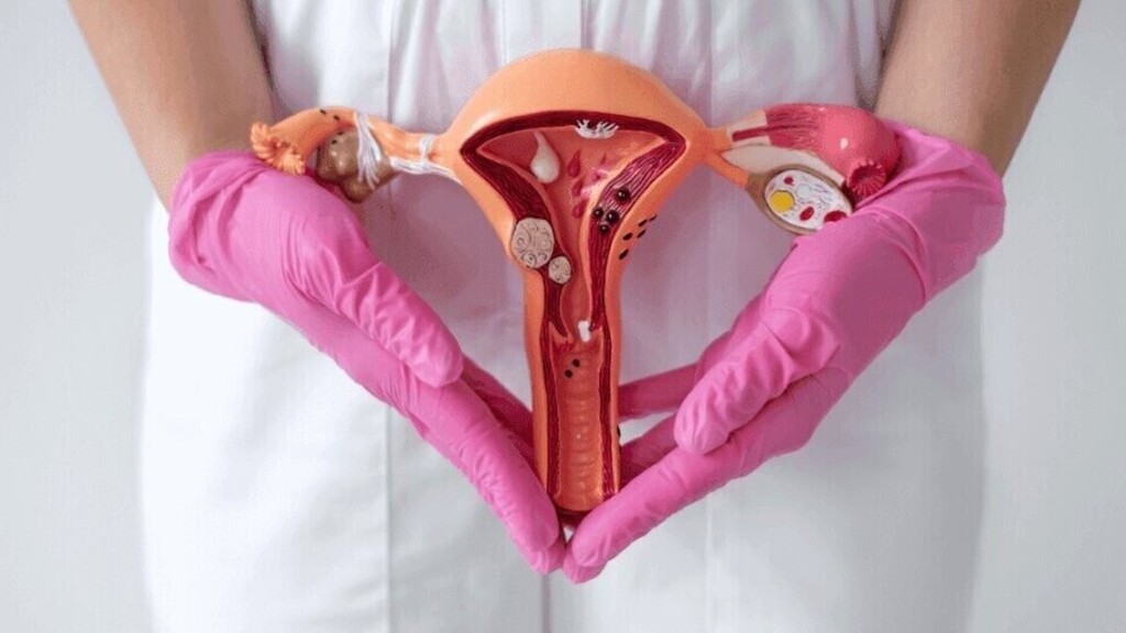 Endométriose : quand des règles très douloureuses cachent une véritable maladie