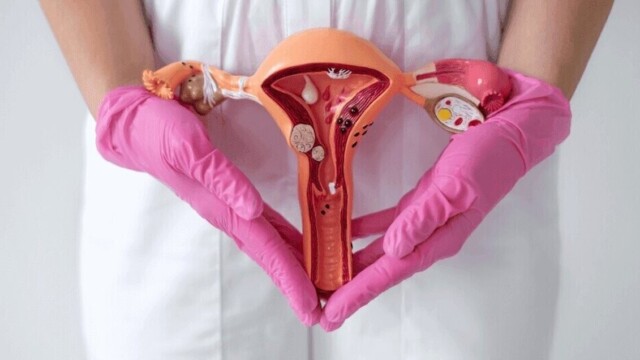 Endométriose : quand des règles très douloureuses cachent une véritable maladie