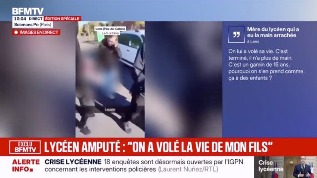«On lui a volé sa vie»: la mère du lycéen de 15 ans, qui a eu la main arrachée à Lens, annonce porter plainte — photo