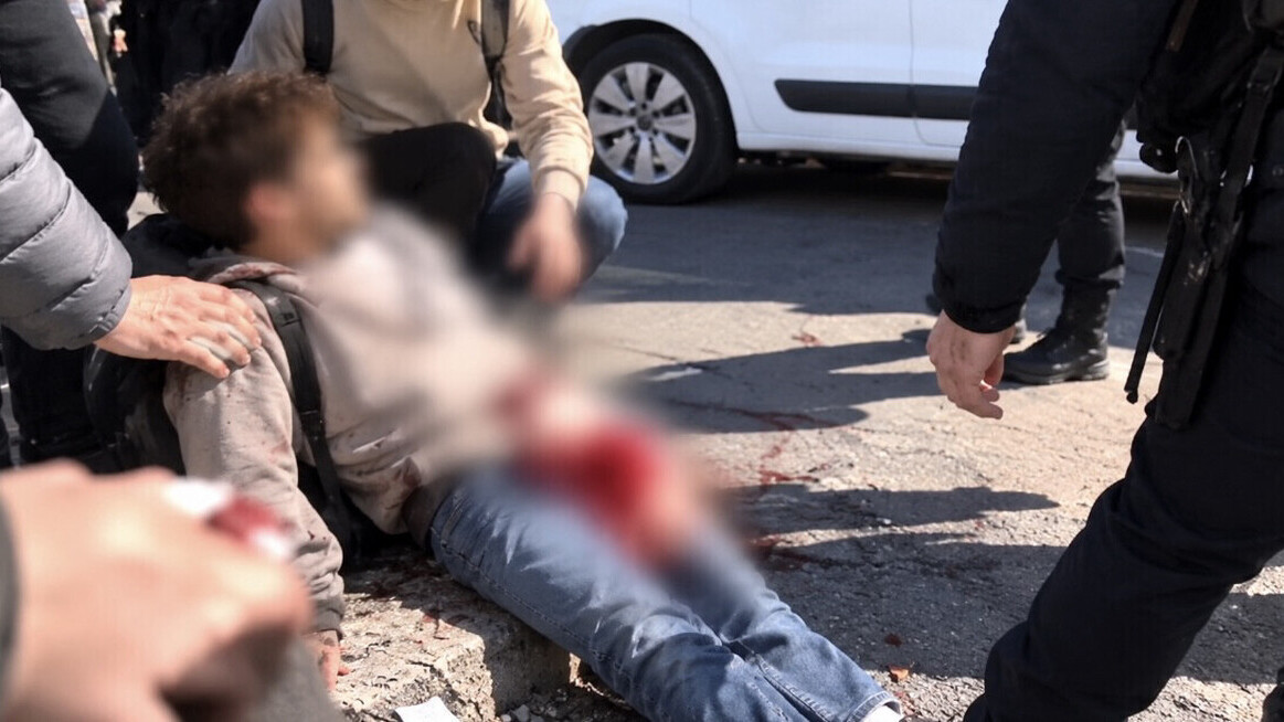 Screenshot Lens, un lycéen de 15 ans se fait arracher la main par une grenade lors d’un blocage: «J’ai vu sa main exploser»