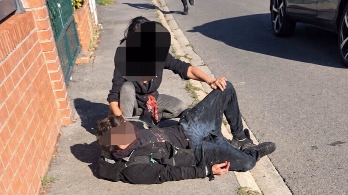 Main arrachée à Lens: le lycéen de 15 ans aurait été aperçu en train de se pencher vers la grenade avant l’explosion