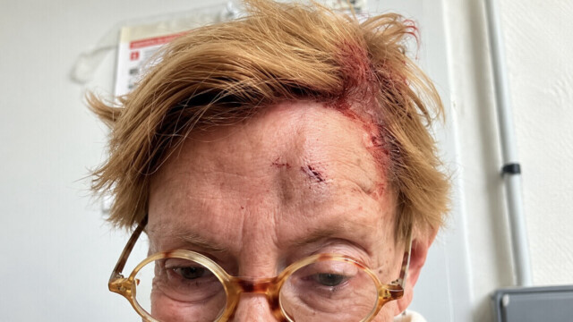 Isabelle Balkany hospitalisée après une violente chute dans un supermarché Leclerc : « Les agents de sécurité ont stoppé mon hémorragie à la tête »