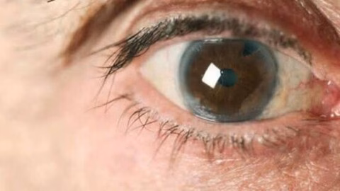Glaucome : cette maladie des yeux qui peut rendre aveugle sans provoquer de douleur