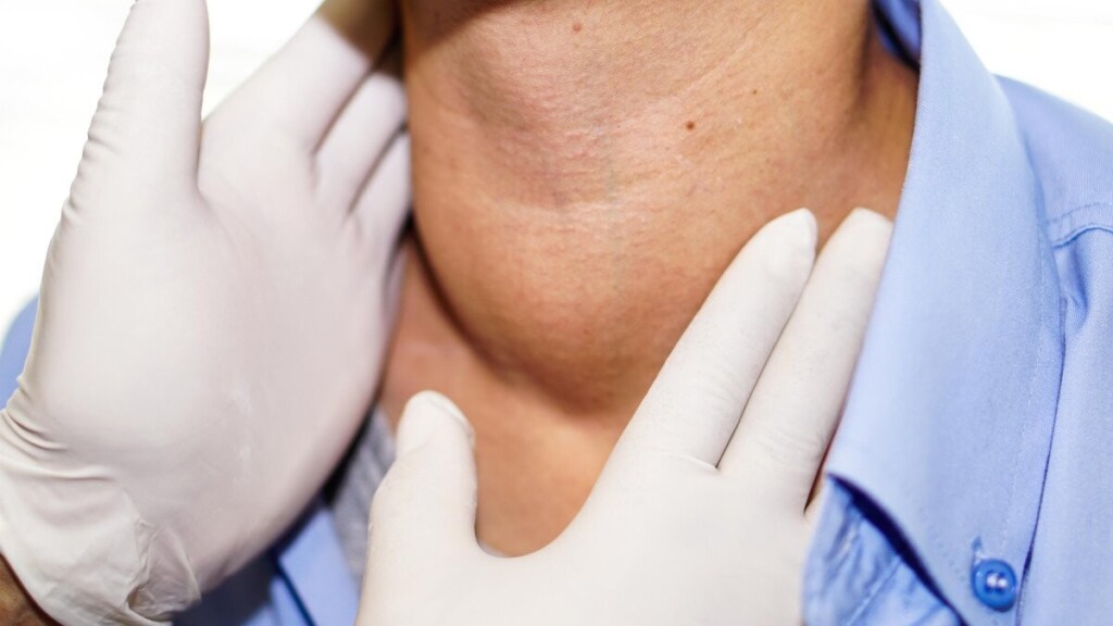 Maladie de Basedow : quand la thyroïde s’emballe et dérègle tout l’organisme