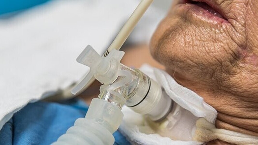 Maladie de Charcot : ces premiers symptômes qui annoncent une paralysie progressive