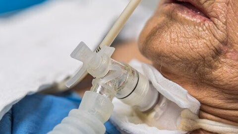 Maladie de Charcot : ces premiers symptômes qui annoncent une paralysie progressive