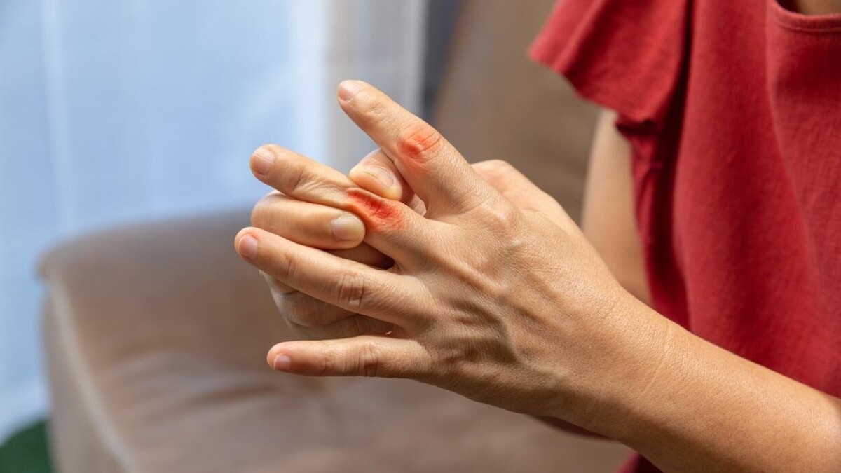 Polyarthrite rhumatoïde : quand des douleurs aux mains révèlent une maladie auto-immune