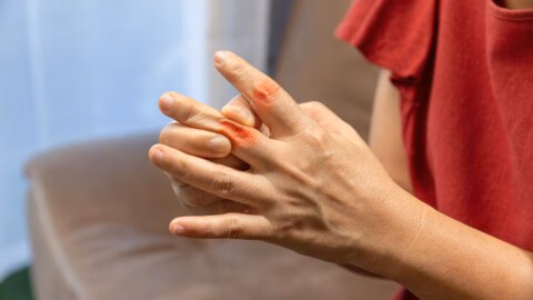 Polyarthrite rhumatoïde : quand des douleurs aux mains révèlent une maladie auto-immune